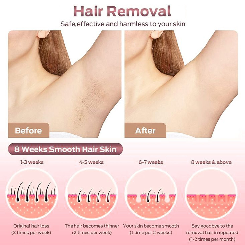 trường hợp công ty mới nhất về Phá cắt tóc bằng laser toàn thân có giá bao nhiêu ở Mỹ?