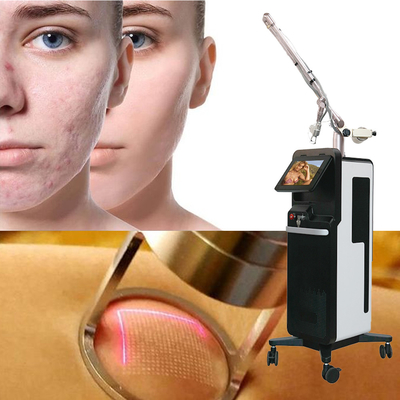 Máy cắt giảm vết rạn da bằng laser CO2