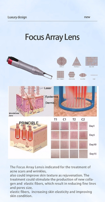 Tất cả trong một Picosecond Laser loại bỏ lông và ND YAG Laser loại bỏ hình xăm máy