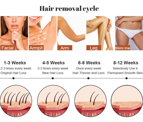Trio 3 bước sóng Diodo Laser 755/808/1064nm cho Alexandrite Ice Laser Hair Removal
