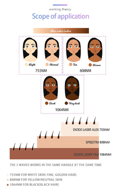 Máy loại bỏ lông bằng laser chuyên nghiệp