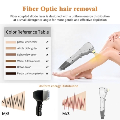 Máy loại bỏ lông laser sợi nhẹ Hệ thống loại bỏ lông vĩnh viễn di động