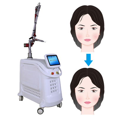 Máy laser Pico 532nm 1064nm 755nm Q Switch Nd YAG thiết bị laser