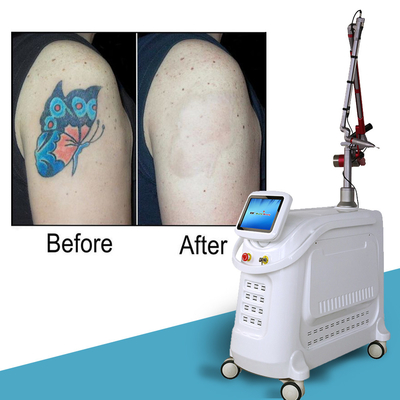4 bước sóng Nd YAG Q Switch Laser Machine Xóa hình xăm