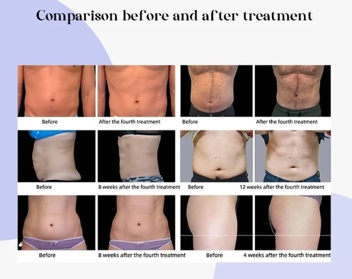 600w 5 tay cầm EMS Máy điêu khắc cho Neo RF 14 Tesla Body Sculpting Body Slimming