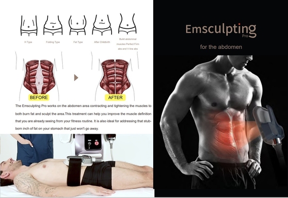 Máy giảm cân EMS tiên tiến 150HZ tần số để giảm cellulite