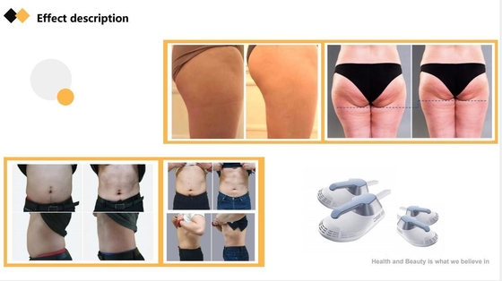 Máy tạo hình cơ thể ABS EMS Máy kích thích cơ bắp EMS điện thương mại