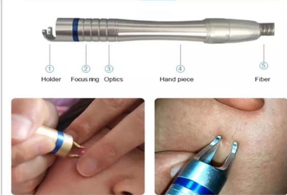 Tái trẻ hóa da Máy laser Diode 980nm Máy loại bỏ tĩnh mạch nhện bằng laser di động