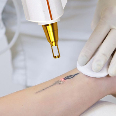 Máy xử lý laser nấm móng da tẩy trắng 1064nm 532nm 1320nm