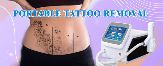 Máy loại bỏ lông Nd YAG y tế 1064nm 532nm Laser thiết bị loại bỏ hình xăm