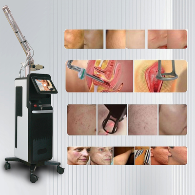 Máy laser carbon dioxide fractional CO2 để làm sáng và thắt da