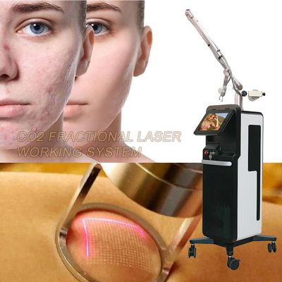 Máy laser carbon dioxide fractional CO2 để làm sáng và thắt da