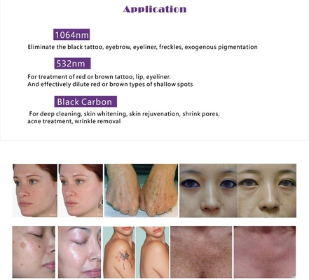 Máy cắt bỏ lông bằng laser OPT đa chức năng IPL RF ND YAG với màn hình cảm ứng 15 inch