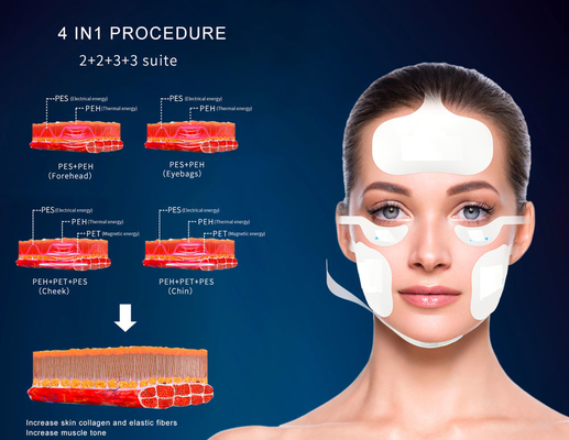 Đường thẳng Magnetic Face Ems rf Khôi phục da nâng da thắt da giảm cân Rf nâng máy
