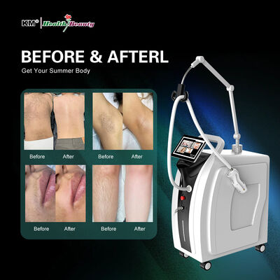 755nm Alex Laser 1064nm Long Pulse Nd Yag Hair Removal Alexandrite Laser Candle Machine Manufacturer Price