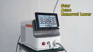 Laser CO2 Fractional Loại bỏ sẹo mụn Tái tạo bề mặt da